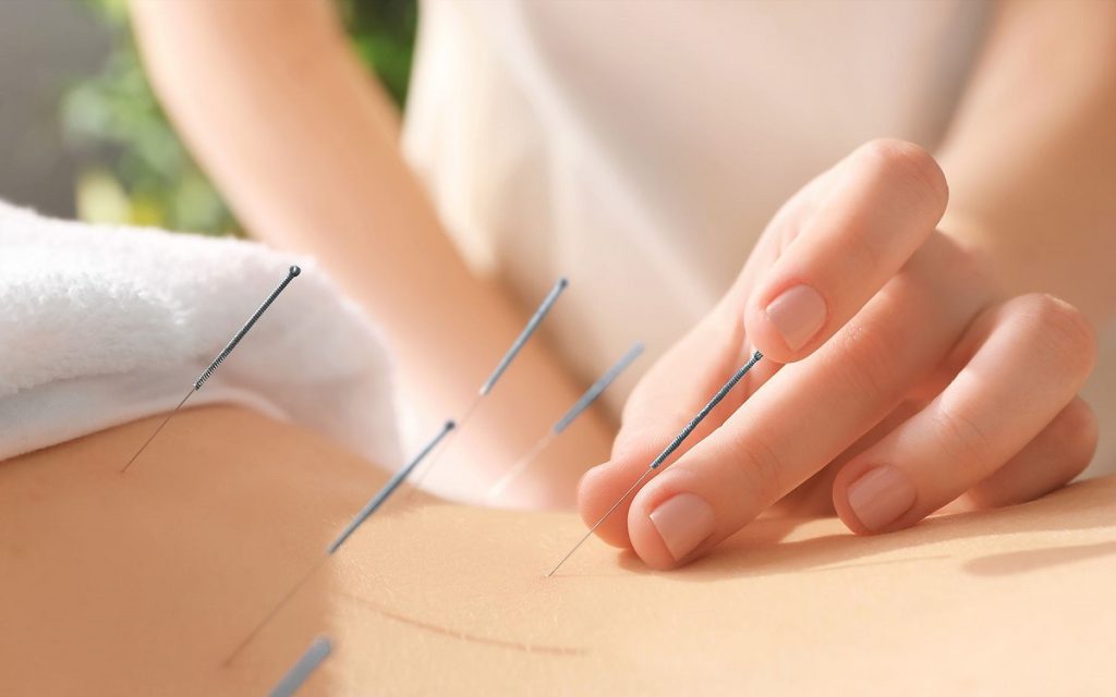 Ce este acupunctura si pentru ce este folosita?